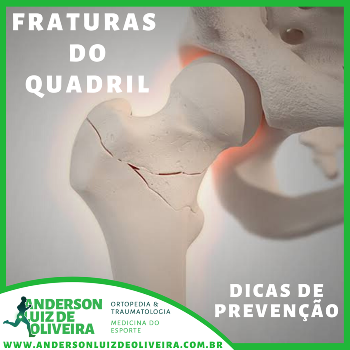 Pubalgia do Atleta - Dr. Anderson Luiz Oliveira