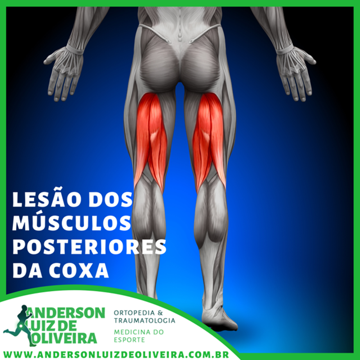 Pubalgia do Atleta - Dr. Anderson Luiz Oliveira