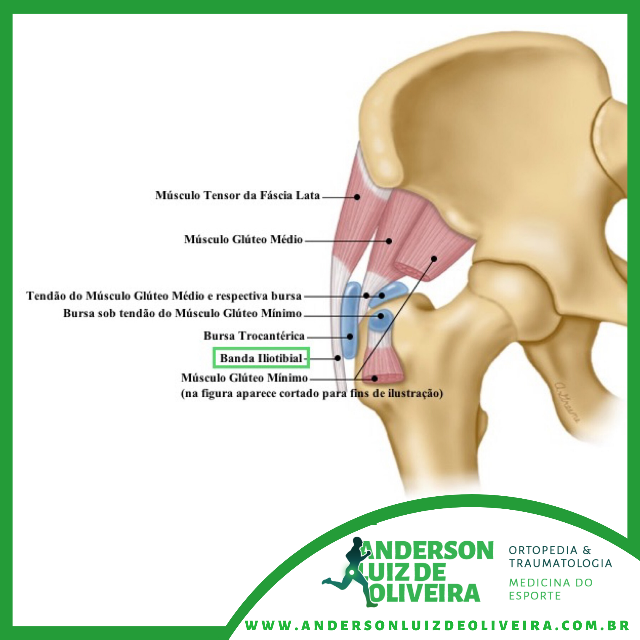 Pubalgia do Atleta - Dr. Anderson Luiz Oliveira