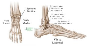 Uma entorse de tornozelo é uma lesão em um ou mais ligamentos que estabilizam o tornozelo.