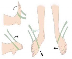 Quando você estiver sem dor, exercícios de resistência podem ser adicionados ao seu programa de terapia para fortalecer os músculos ao redor do tornozelo.
