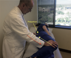 Fig. 4. Teste de contração ativa do piriforme. Na posição lateral, o paciente empurra o calcanhar para baixo contra a maca com abdução e rotação externa ativas do quadril (seta amarela) contra a resistência do examinador (seta laranja). O examinador palpa no nível do piriforme.